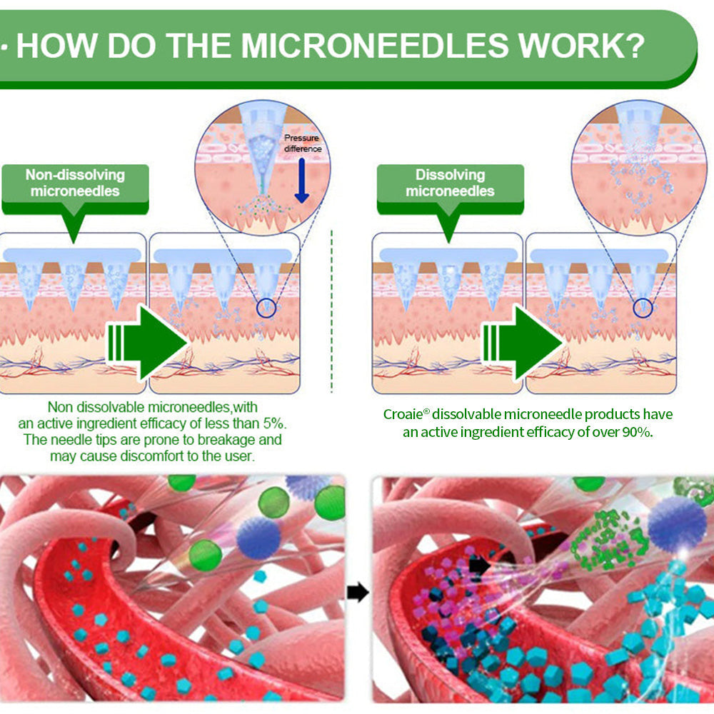 [See results in 7 days]🔔Croaie® SMGT-GLP-1 Nano Microneedle Patch & Matrixyl™  3000（Painless, long-lasting, addressing diabetes, obesity, and cardiovascular diseases）💚