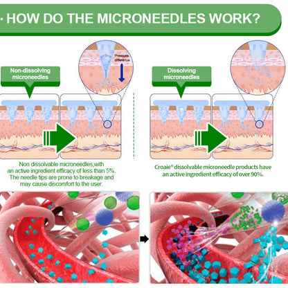 [See results in 7 days]🔔Croaie® SMGT-GLP-1 Nano Microneedle Patch & Matrixyl™  3000（Painless, long-lasting, addressing diabetes, obesity, and cardiovascular diseases）💚
