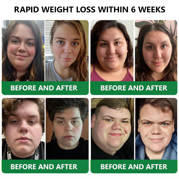 [See results in 7 days]🔔Croaie® SMGT-GLP-1 Nano Microneedle Patch & Matrixyl™  3000（Painless, long-lasting, addressing diabetes, obesity, and cardiovascular diseases）💚