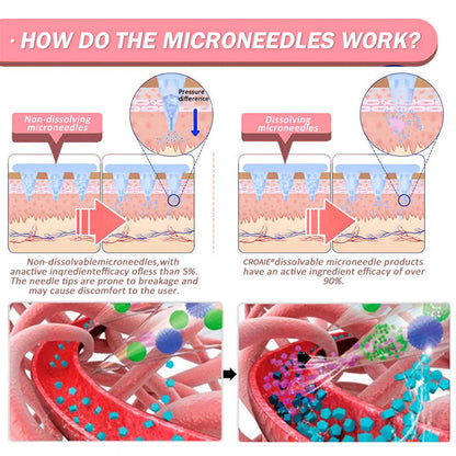 Croaie® SMGT-GLP-1 Nano Microneedle Patch – Painless, Long-Lasting Relief for Diabetes, Obesity & Heart Health ✨ Visible Results in 7 Days