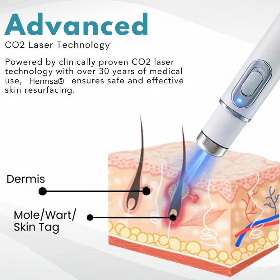 ✨Hermsa® Removal Laser Pen